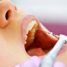 Tratamientos Odontológicos
